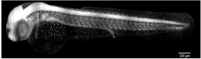 Abbildung 1: Eine OpenSPIM-Aufnahme von einem 48 Stunden alten, lebenden Zebrafisch-Embryo, in dem bestimmte Strukturen wie das Nervensystem und Zellkerne mit Grün-Fluoreszierendem Protein (GFP) markiert sind